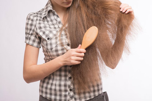 Causas y motivos de la caída del cabello
